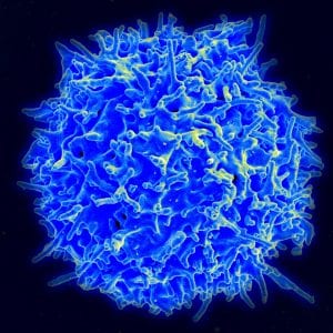 Normal human T cells, which are white blood cells involved in the immune response, are regulated by molecules that bind to surface receptors. Researchers at MIT recently demonstrated that one such signaling molecule, known as IL-17a, can produce autism-like symptoms in mice. (Source: Wikipedia, NIH, NIAID)